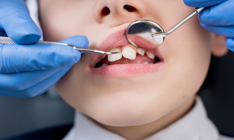criança-no-dentista-saúde-oral-1.jpg